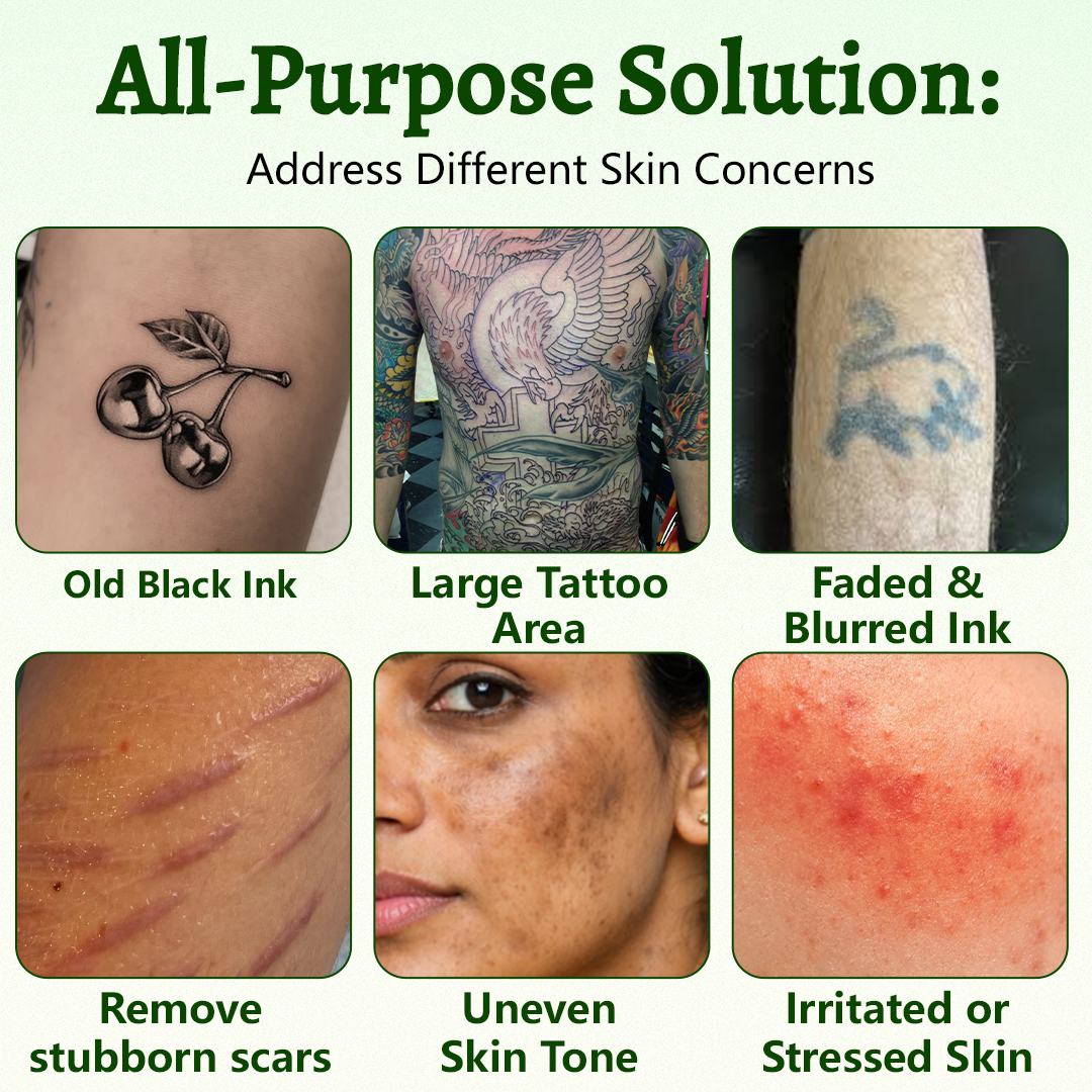 Ceoerty® PureAlgae Ink Removal Support Spray 🌿 — Say Goodbye to Old Tattoo Pigment 💚, Fade Stubborn Ink ✨, Repair & Smooth Treated Skin 💧, Non-Laser ✅, Try It Now! 🔥