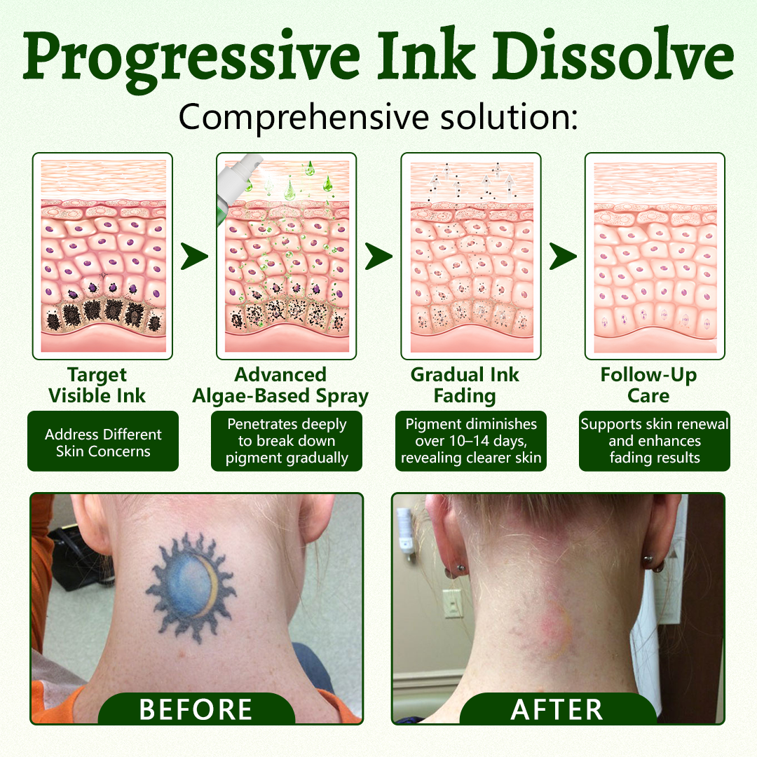 Ceoerty® PureAlgae Ink Removal Support Spray 🌿 — Say Goodbye to Old Tattoo Pigment 💚, Fade Stubborn Ink ✨, Repair & Smooth Treated Skin 💧, Non-Laser ✅, Try It Now! 🔥