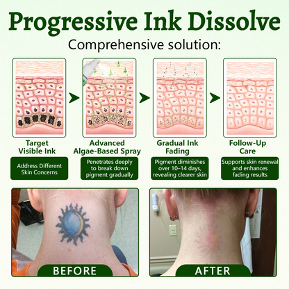 Ceoerty® PureAlgae Ink Removal Support Spray 🌿 — Say Goodbye to Old Tattoo Pigment 💚, Fade Stubborn Ink ✨, Repair & Smooth Treated Skin 💧, Non-Laser ✅, Try It Now! 🔥