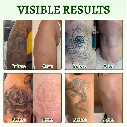Ceoerty® PureAlgae Ink Removal Support Spray 🌿 — Say Goodbye to Old Tattoo Pigment 💚, Fade Stubborn Ink ✨, Repair & Smooth Treated Skin 💧, Non-Laser ✅, Try It Now! 🔥